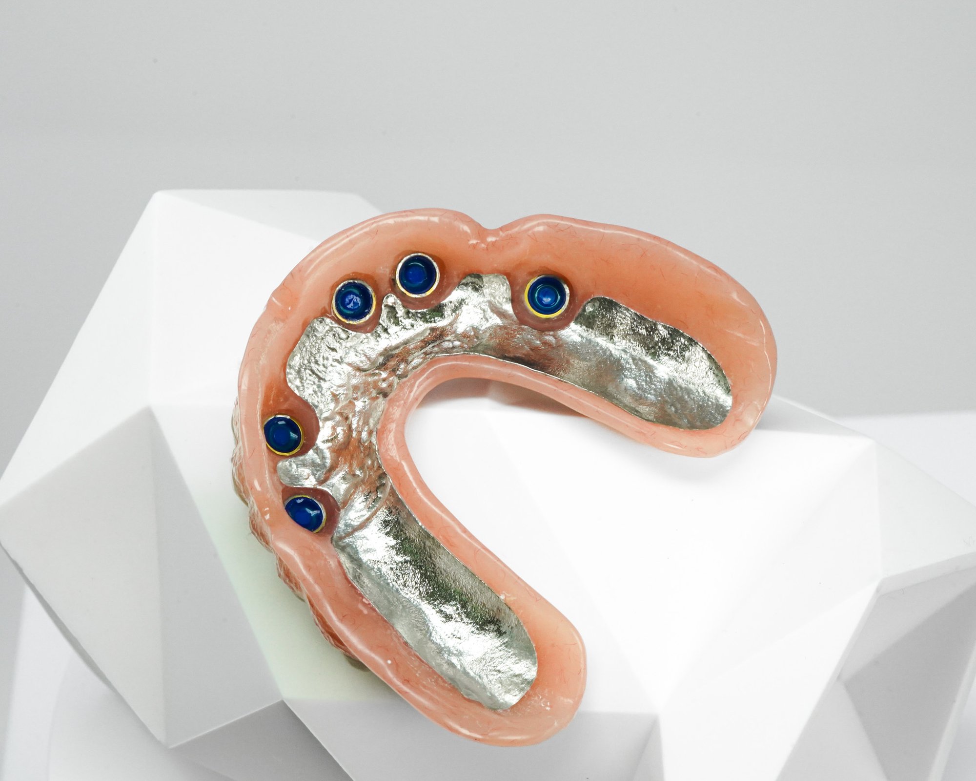 LOCATOR® Overdenture